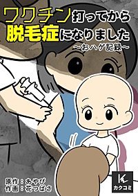 ワクチン打ってから脱毛症になりました～おハゲ記録～