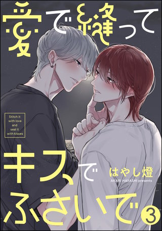 愛で縫ってキスでふさいで(分冊版)【第3話】