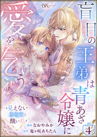 盲目の王弟は青あざ令嬢に愛を乞う ～見えないあなたと醜い私～ コミック版（分冊版）【第4話】