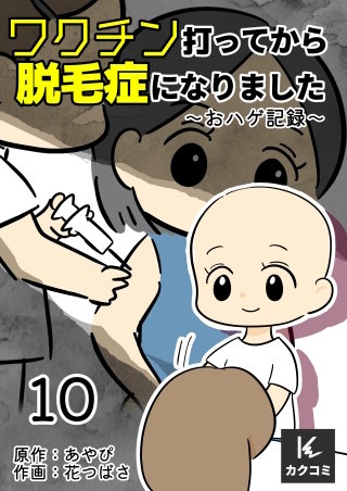 ワクチン打ってから脱毛症になりました～おハゲ記録～(10)