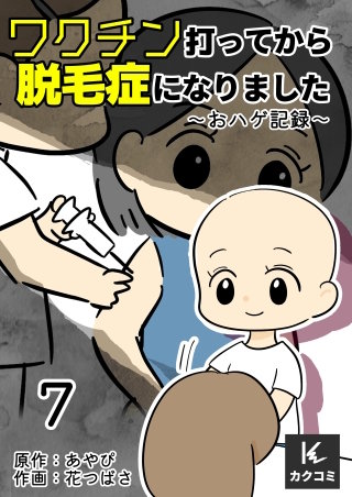 ワクチン打ってから脱毛症になりました～おハゲ記録～(7)